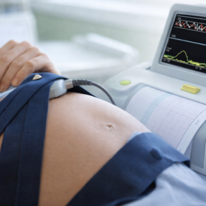monitoreo fetal con lectura