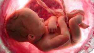 Obstetricia cordocentesis qué es