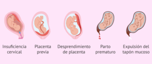 Obstetricia motivos sangrado segundo y tercer trimestre 670x285